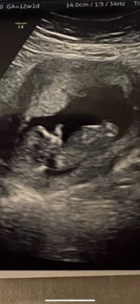 Babies due April 2023 Thread 6