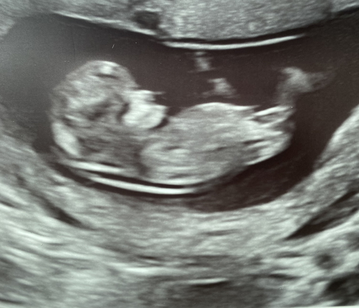 Gender Predictions? Just for fun! 