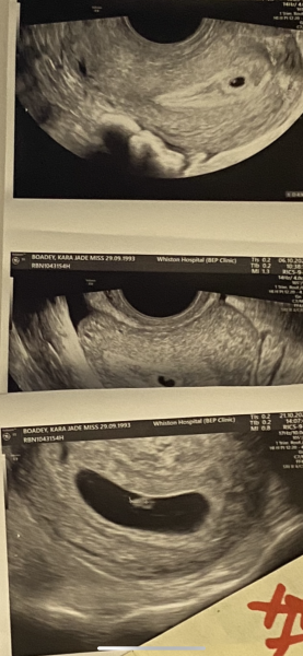 Early Pregnancy Unit 