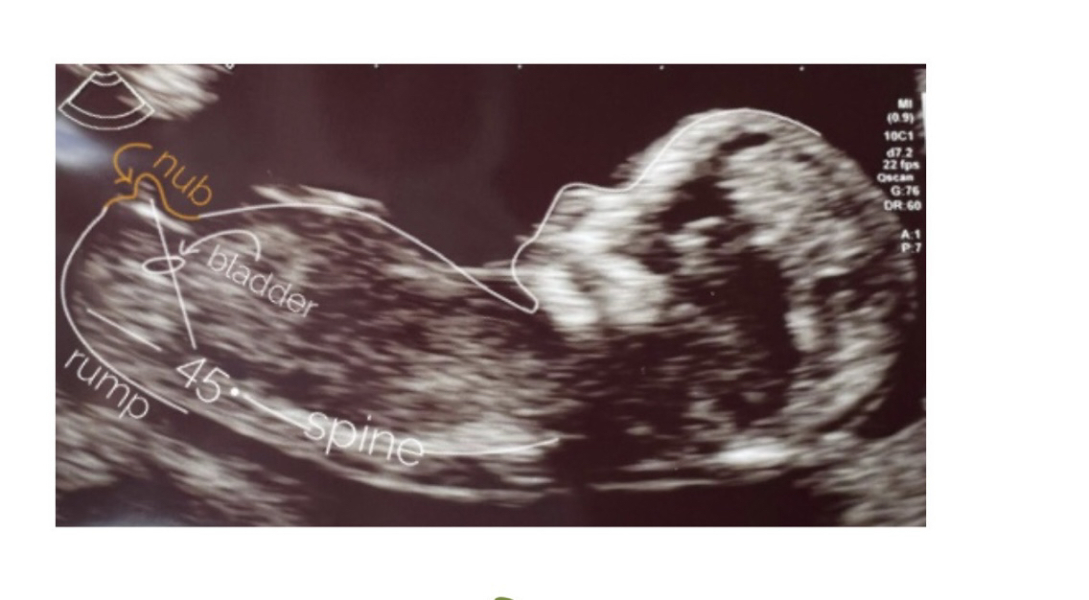 Babies due April 2023 Thread 6