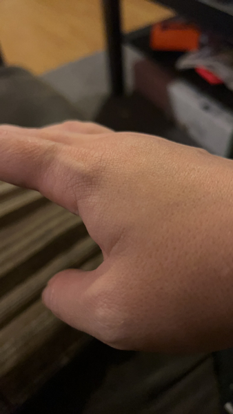 Wtf has happened to my hand