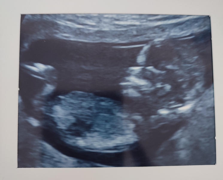 Babies due April 2023 Thread 6