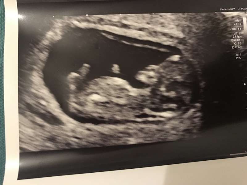 10weeks 4days any guesses? :)
