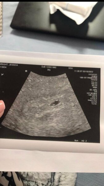 June 2023 Babies 🌞