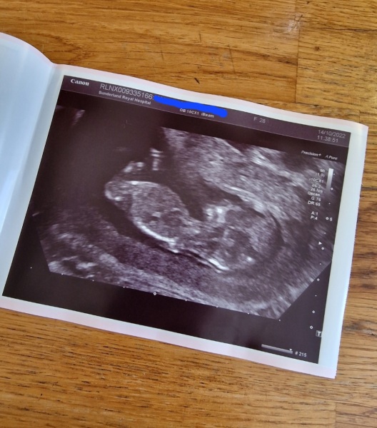 Due April 2023 💕 into the second trimester 🍂🎇