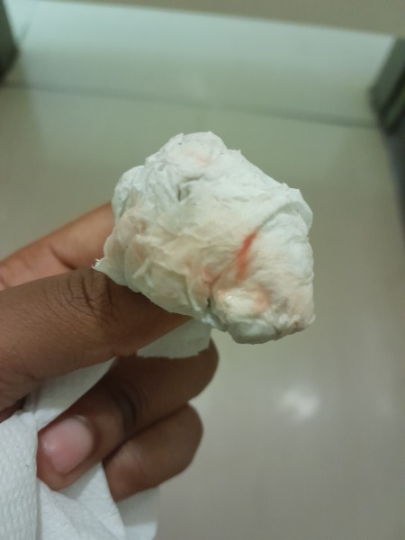 Could I be pregnant?