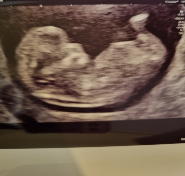 Gender guess