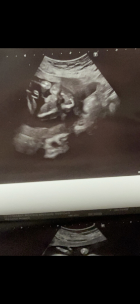 Due March 2023 - thread 4