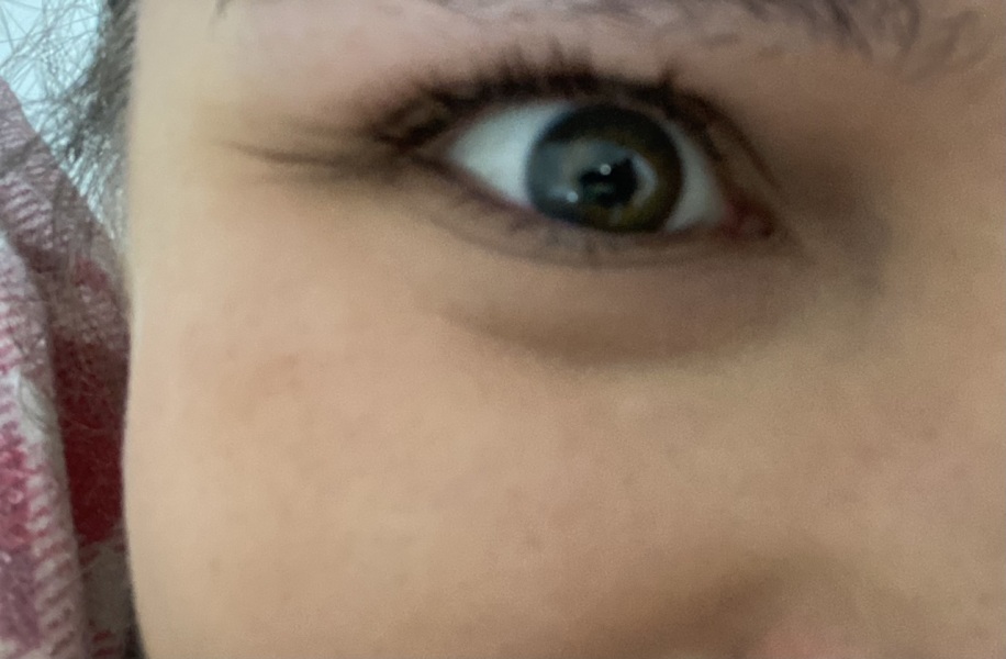 Are these crows feet?