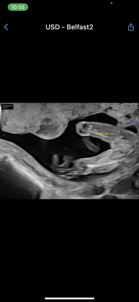 Girl or boy? Potty shot 
