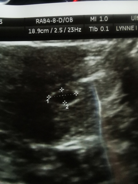 June 2023 Babies 🌞