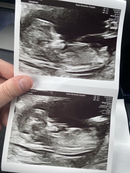 Due April 2023 💕 into the second trimester 🍂🎇