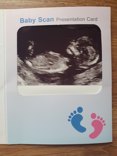Babies due April 2023 Thread 6