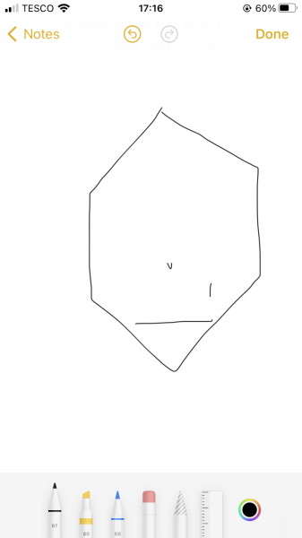 Post C-section questions 