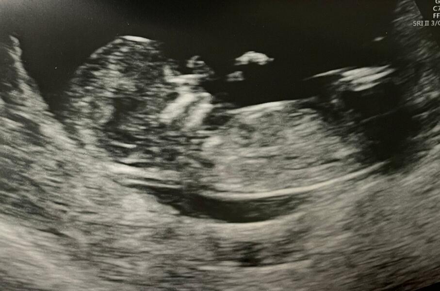 IVFers Due Mar & Apr 2023