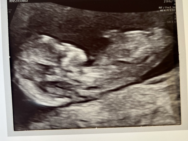 Babies due April 2023 Thread 6