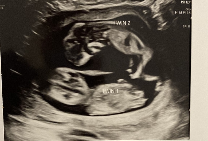 Babies due April 2023 Thread 6