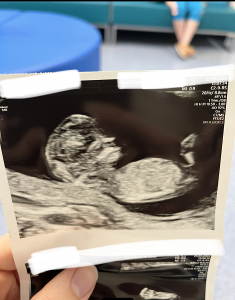 Nub theory - baby already born so will update with correct gender 