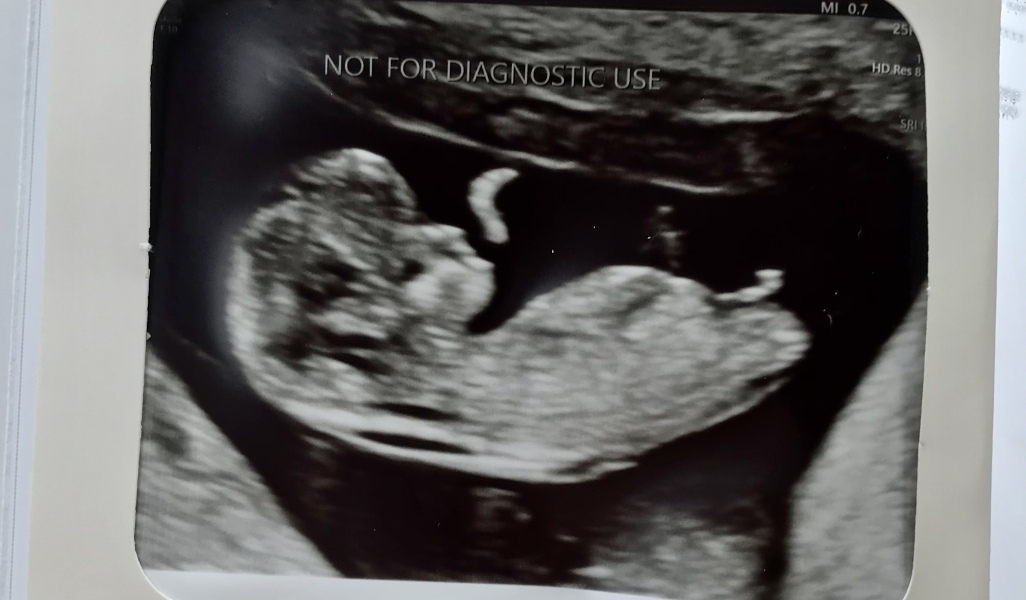 Babies due April 2023 Thread 6