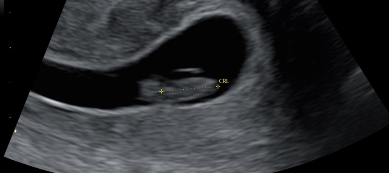 June 2023 Babies ☀️ (thread two)