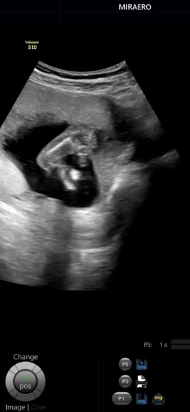 Boy or Girl ? 16 weeks potty shots