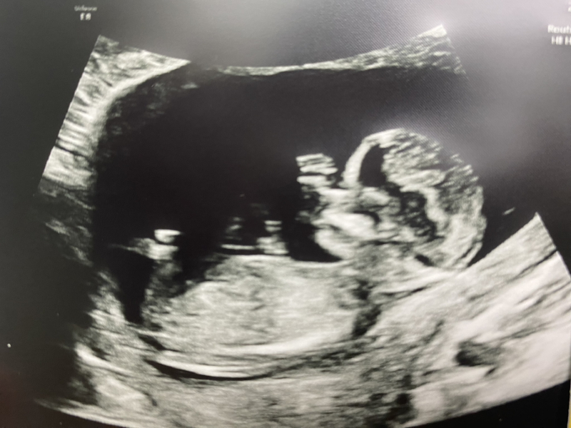 Babies Due April 2023 thread 5