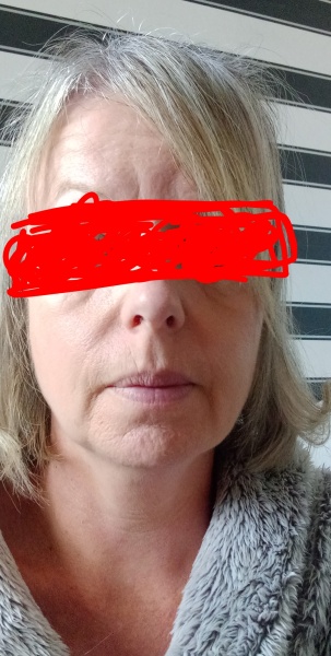 Skin care help