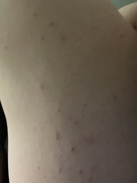 What are these spots?