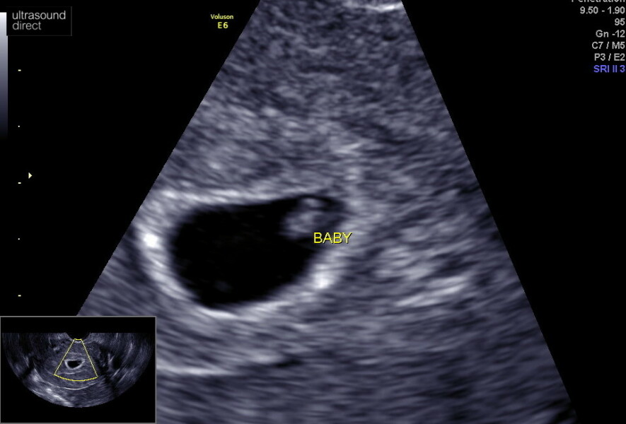 June 2023 Babies 🌞