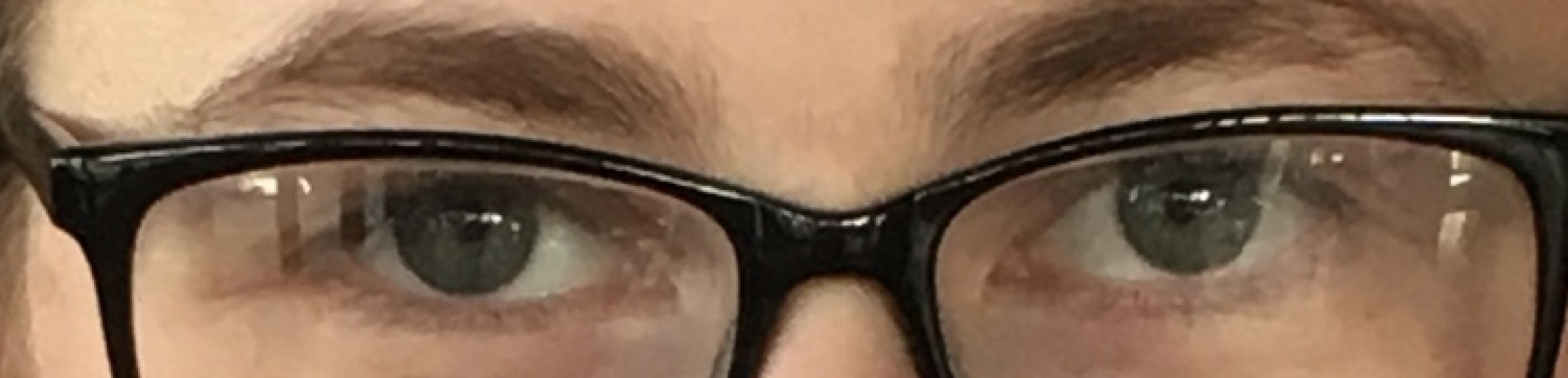 Drifting eye? 