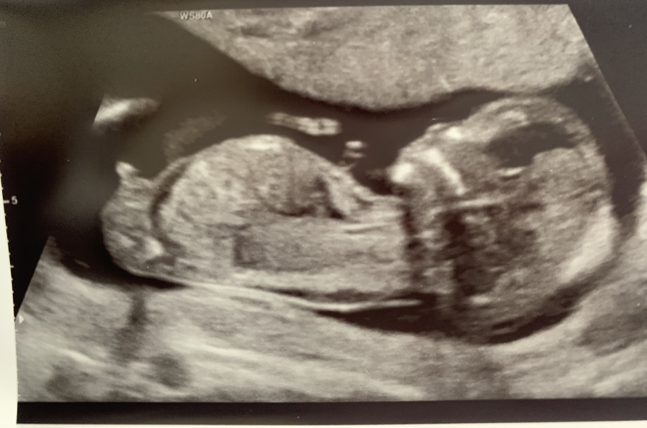 Babies due April 2023 Thread 6