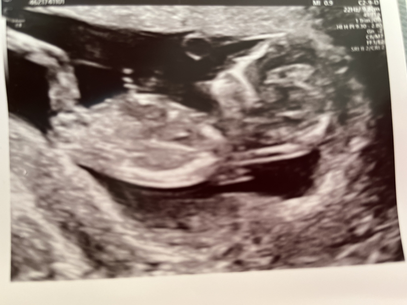 Babies due April 2023 Thread 6