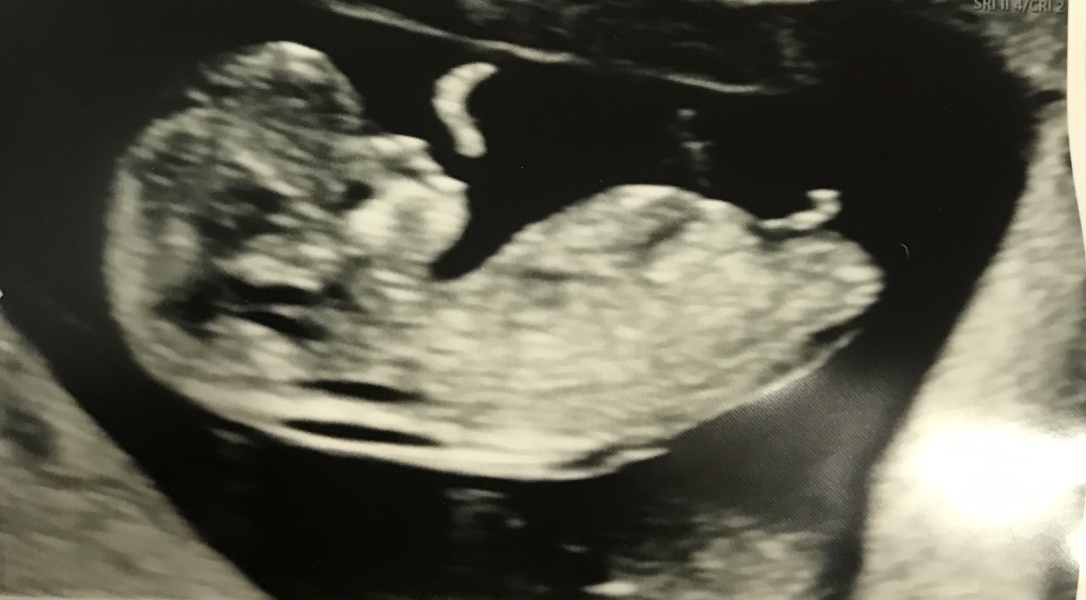 Babies due April 2023 Thread 6