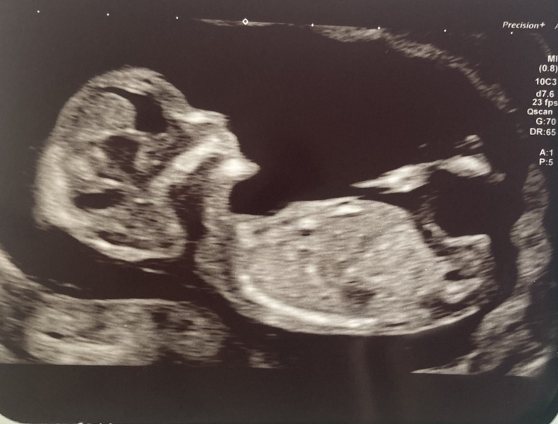 Due April 2023 💕 into the second trimester 🍂🎇