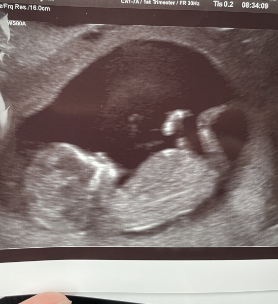 Babies due April 2023 Thread 6