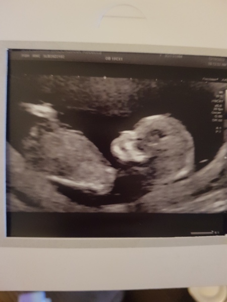 Babies due April 2023 Thread 6