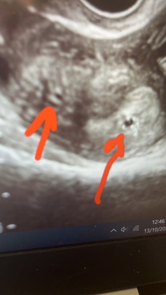 Could it be twins
