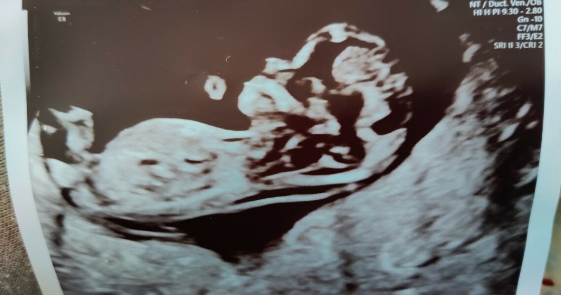 Babies due April 2023 Thread 6