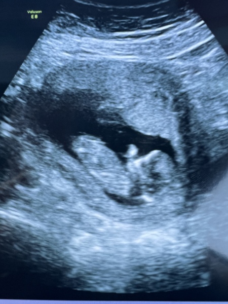 Babies due April 2023 Thread 6