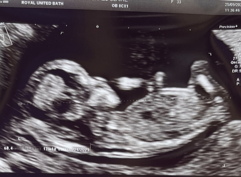Babies Due April 2023 thread 5
