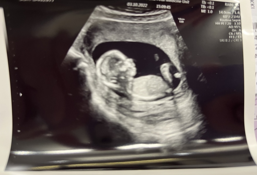 Babies due April 2023 Thread 6