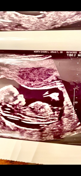 Scan pic - anyone guess gender?