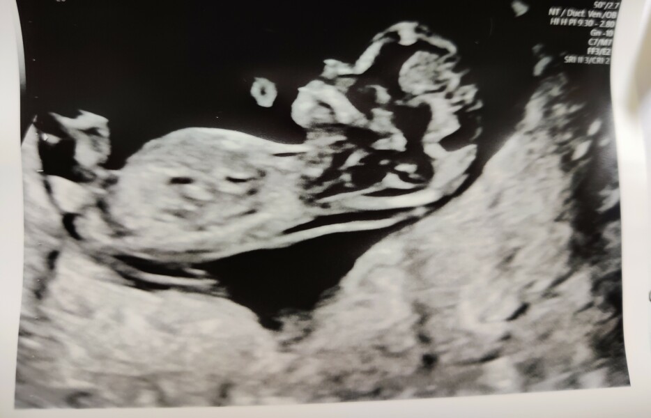 Babies due April 2023 Thread 6