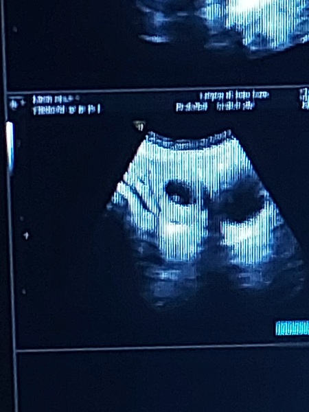 Hoping for BFP September/October