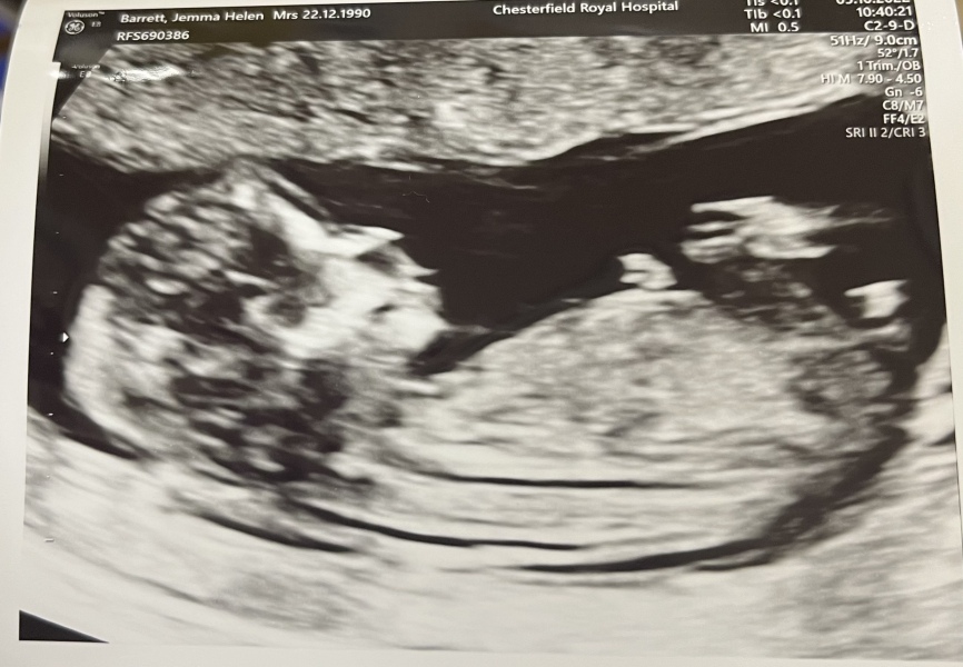 Babies due April 2023 Thread 6