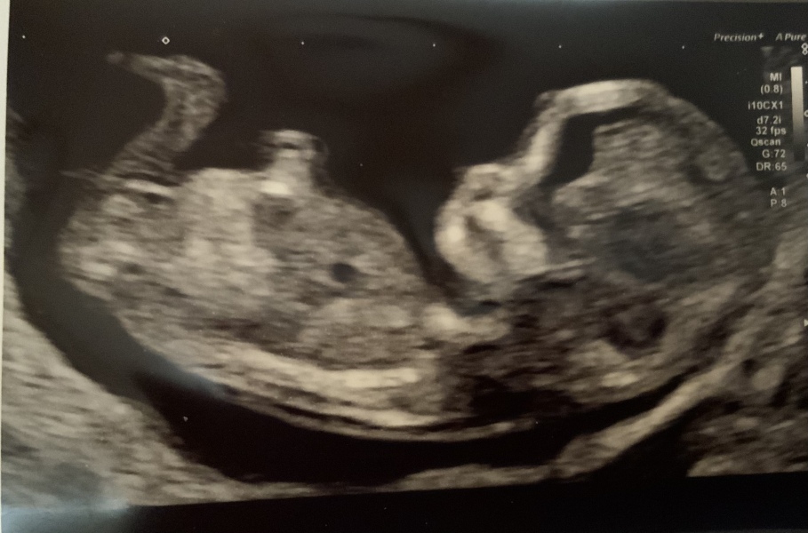 Babies due April 2023 Thread 6