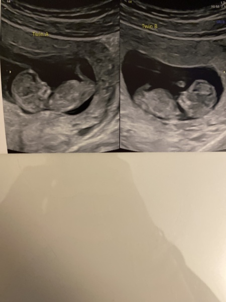 Babies due April 2023 Thread 6