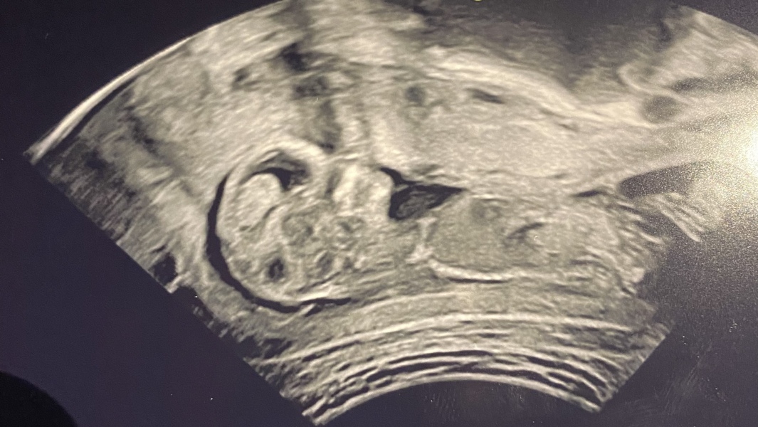 Due April 2023 💕 into the second trimester 🍂🎇