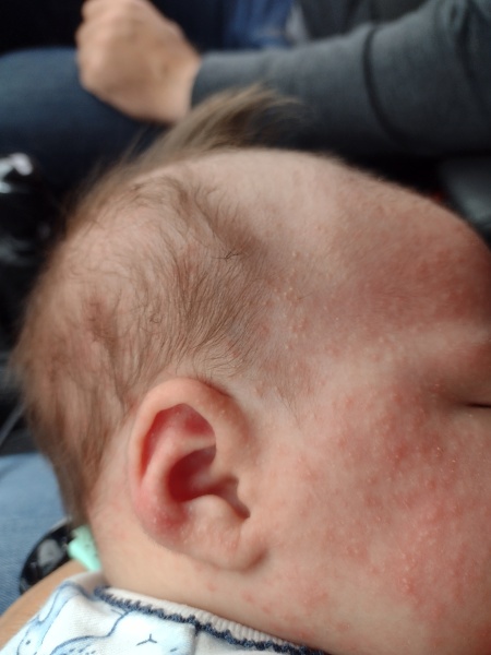 Due September 2022 (Thread 8!)