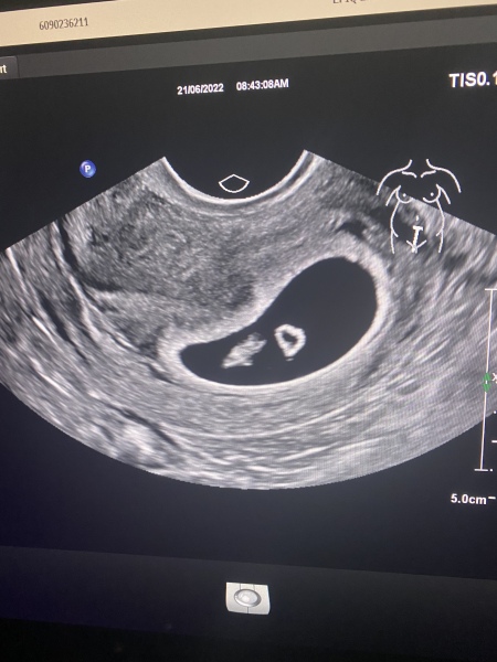 Will a scan only make it worse?